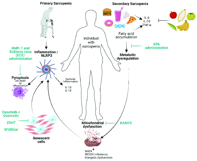 Illustration of factors involved in primary and secondary sarcopenia New potential